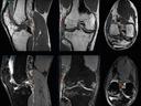 Transforming care delivery with MRI application GOKnee3D
