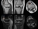Transforming care delivery with MRI application GOKnee3D