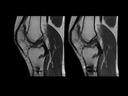 Cost-efficient MRI scanner Magnetom Sempra