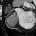 Modern scanning technologies lower the dose of radiation and speed up the pediatric imaging process.