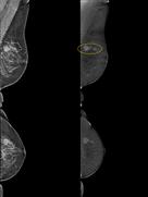 The use of mammographhy for functional imaging is emerging as a new paradigm.