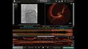 OCT imaging looks at structures.