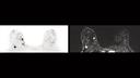 AI is key for an image interpretation technology also seen in breast cancer imaging.