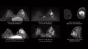 The data-based approach to image interpretation called radiomics enables recognition of imaging signatures.