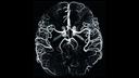 Ultra-high resolution of 400 micron showing even the smallest vessels in the human brain. © FAU, Erlangen, Germany