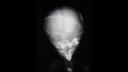 Stories X-Ray Technologies Our Brain