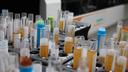 Routine laboratory examinations reveal a number of abnormalities in COVID-19 patients.