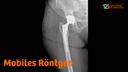 Röntgenbild einer künstlichen Hüfte post-OP