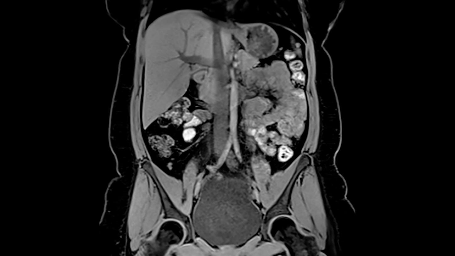 The Mri At 50 What Lies Ahead