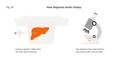 How diagnosis works: biopsy