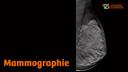 News Stories Dossier Mammograhie