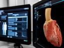 CT Photon Counting Heart Imaging