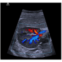 Conventional Doppler