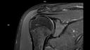 Coronal PD FS DR Sharp-MAGNETOM Sola/Coil-UltraFlex 18 Small/Resolution-512/Scan Time-3:10
