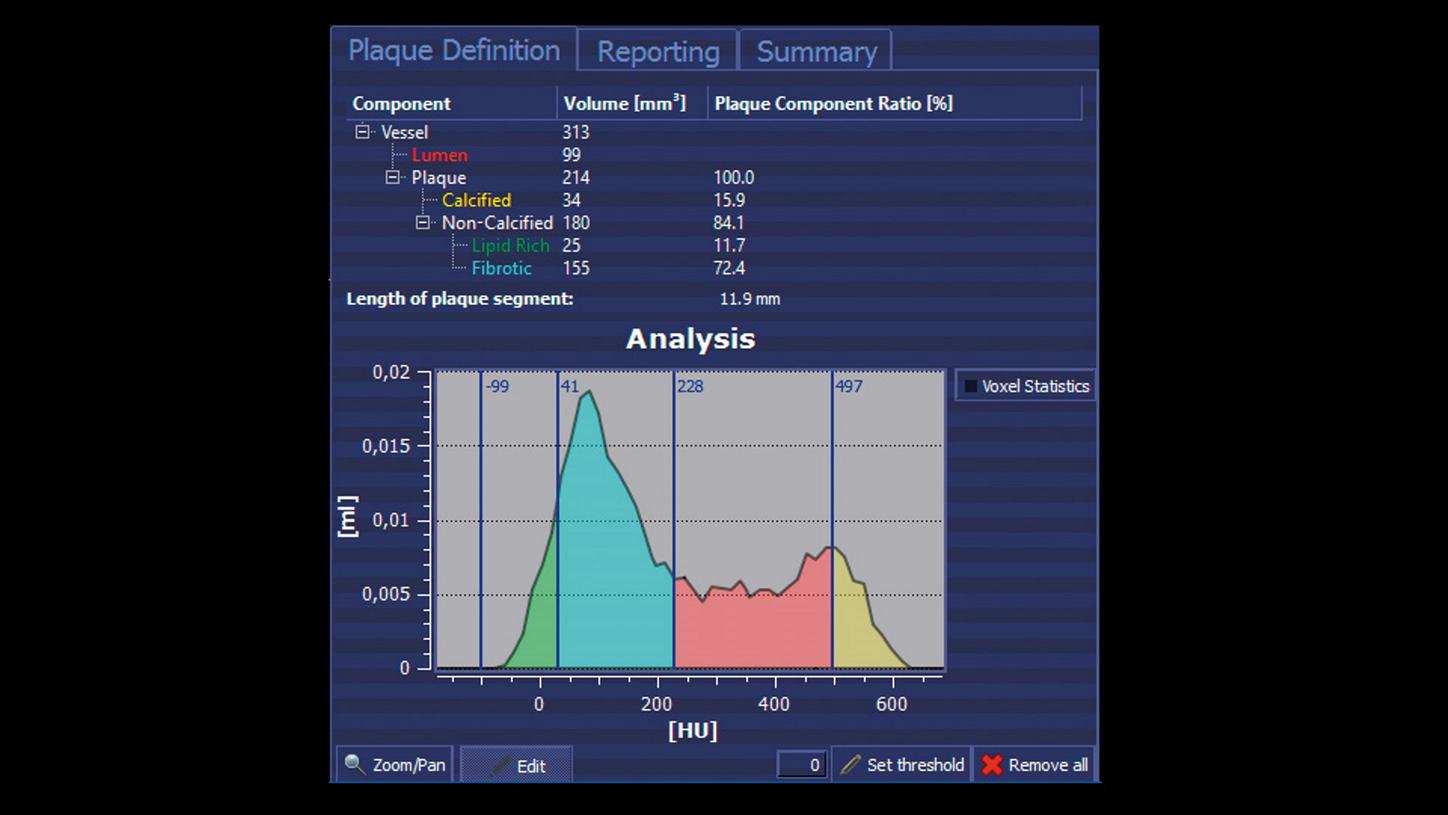 frontier bolsa options