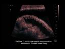 ACUSON Antares - Body/Non-Oncology - Whole Body