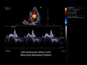 ACUSON Antares - Cardiology/Cardiovascular - Heart