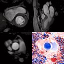 Functional and flow imaging for Cardiac