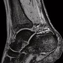 Ankle – Microscopic imaging for orthopedics