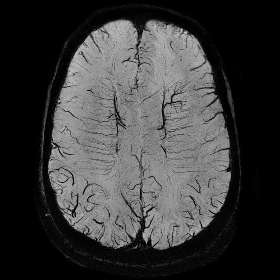 Magnetom 7t Head Swi 7t Imaging