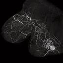 MIP (Maximal Intensity Projection) of syngo VIEWS