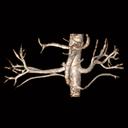 Abdominal Angiography A. renalis, T2 3D TrueFISP FatSat syngo NATIVE VRT, GRAPPA 2