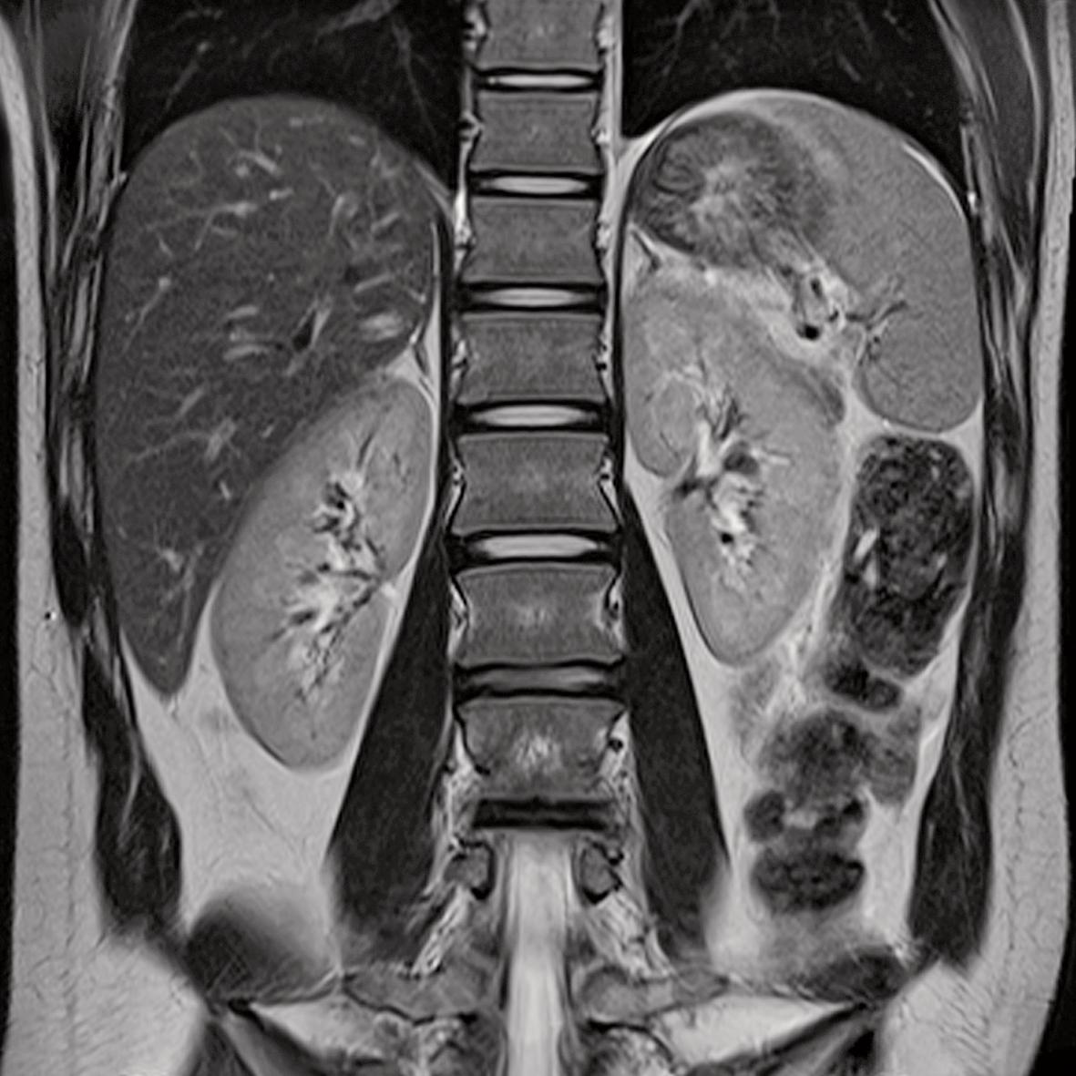 Resonance Imaging Clinical Images