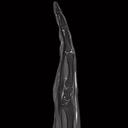 Finger, PD TSE SPAIR, GRAPPA 3