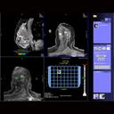 syngo BreVis Biopsy