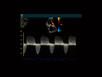 Cypress System PLUS - Cardiac - Aortic Stenosis and AI with CW Doppler