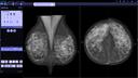 syngo.Breast Care