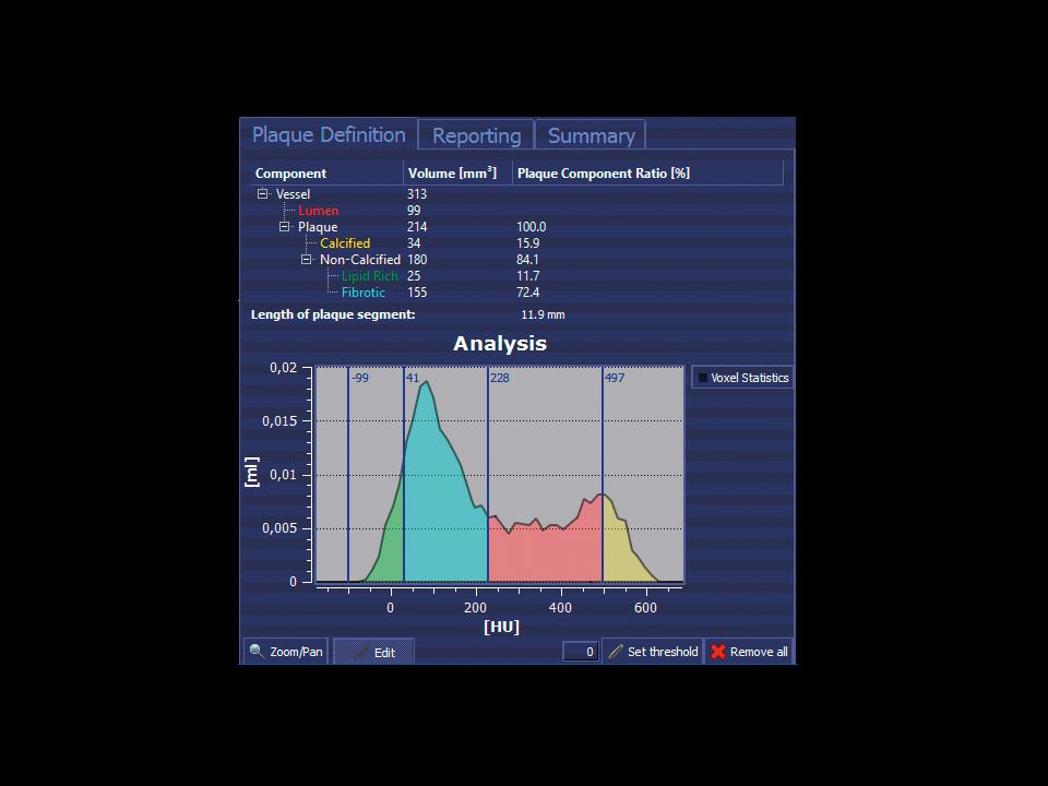 frontier bolsa sizes