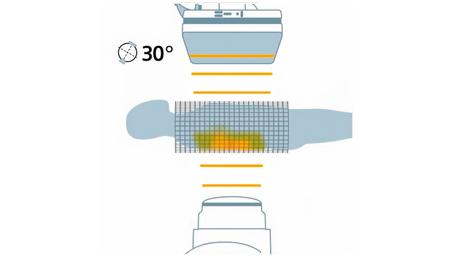 CARE+CLEAR in Interventional Imaging