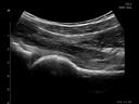 ACUSON Freestyle Series ultrasound systems for MSK
