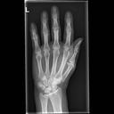 Mobilett Mira Max Hand d.v. Image