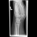 Mobilett Mira Max Wrist lat. Image