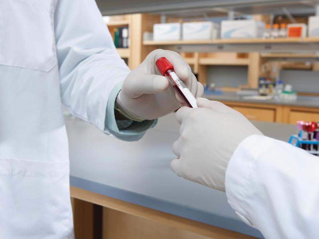 TORCH and Special ID Assays