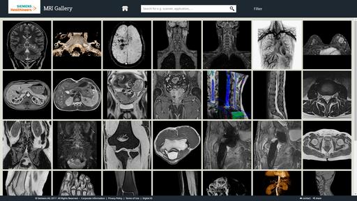 MAGNETOM Prisma - MRI Scanner