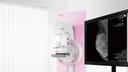Mammography, how it all began