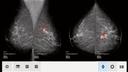 ScreenPoint image