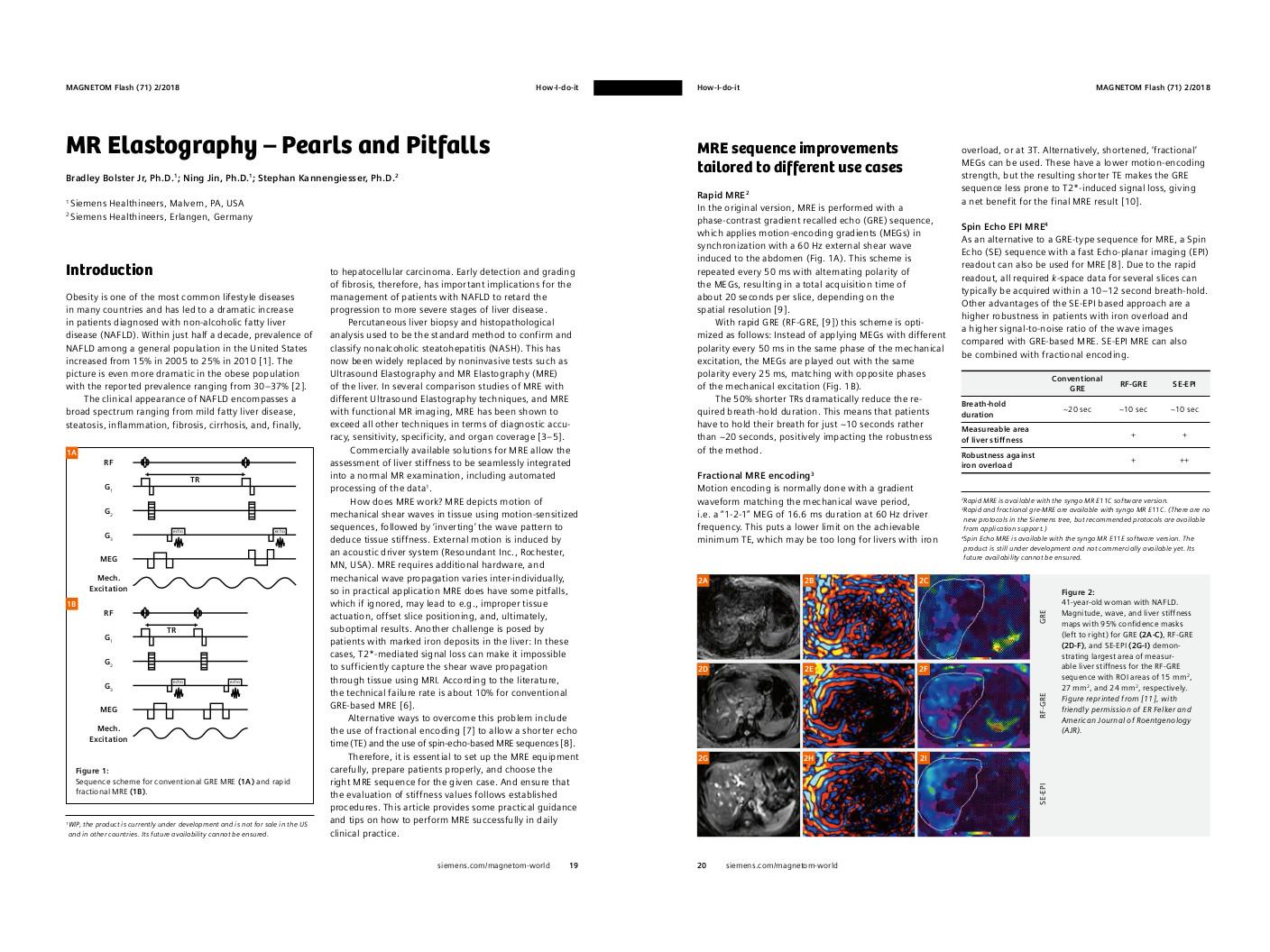 How-I-do-it: MR Elastography – Pearls and Pitfalls