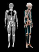 Pediatric imaging is growing at Spire Manchester since the DSCT has increased referrals to the department by three to four times.