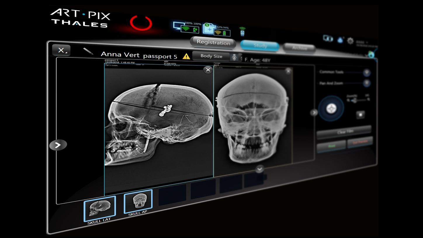 XRay Products Accessories