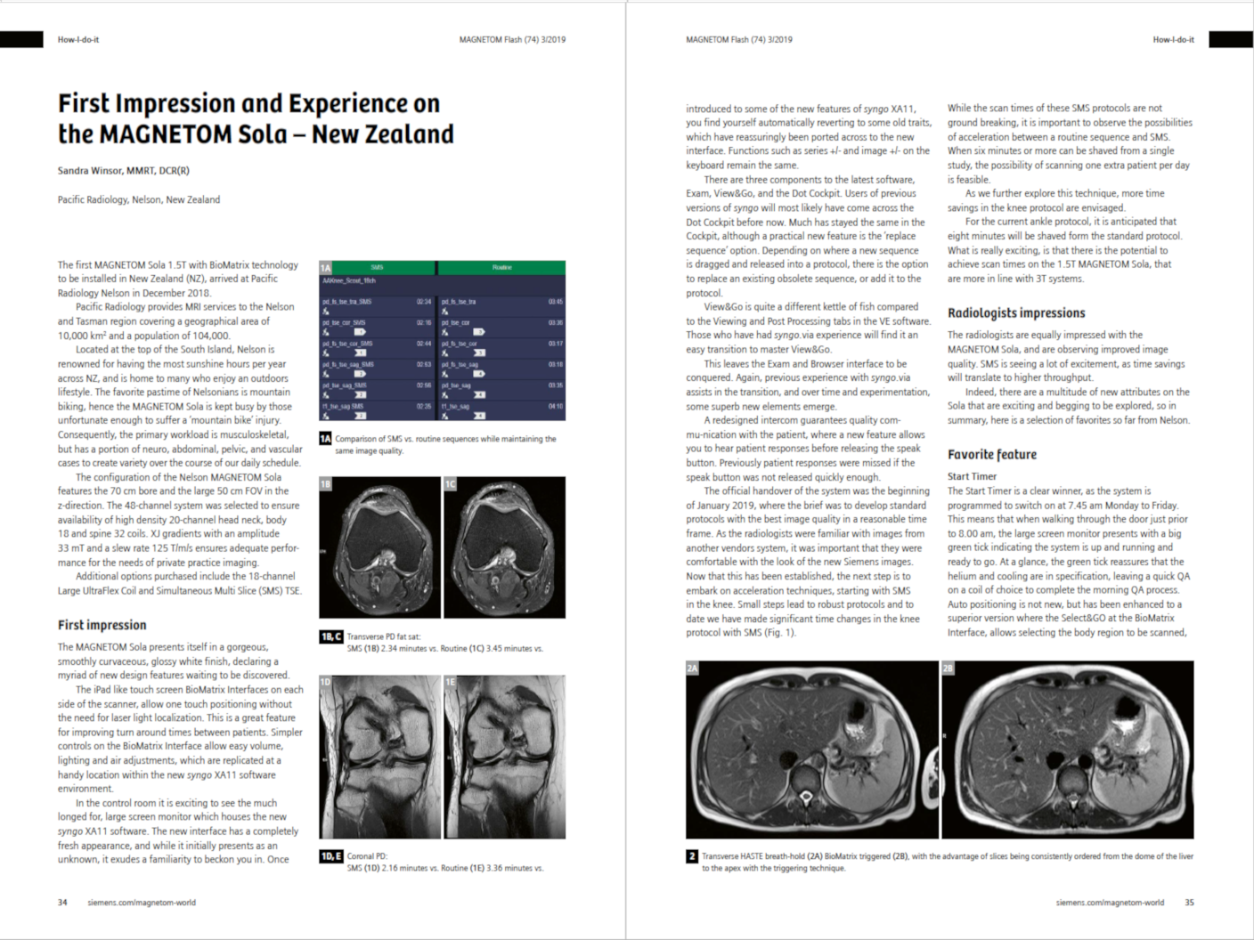 First Impression and Experience on the MAGNETOM Sola – New Zealand
