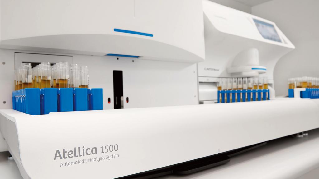 Atellica 1500 Automated Urinalysis System