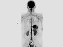 Whole Body Diffusion-MAGNETOM Altea