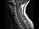 Sagittal T1 tse-MAGNETOM Vida