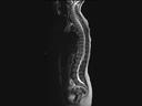 Sagittal T2 tse-MAGNETOM Vida