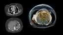 ct scanner clinical image
