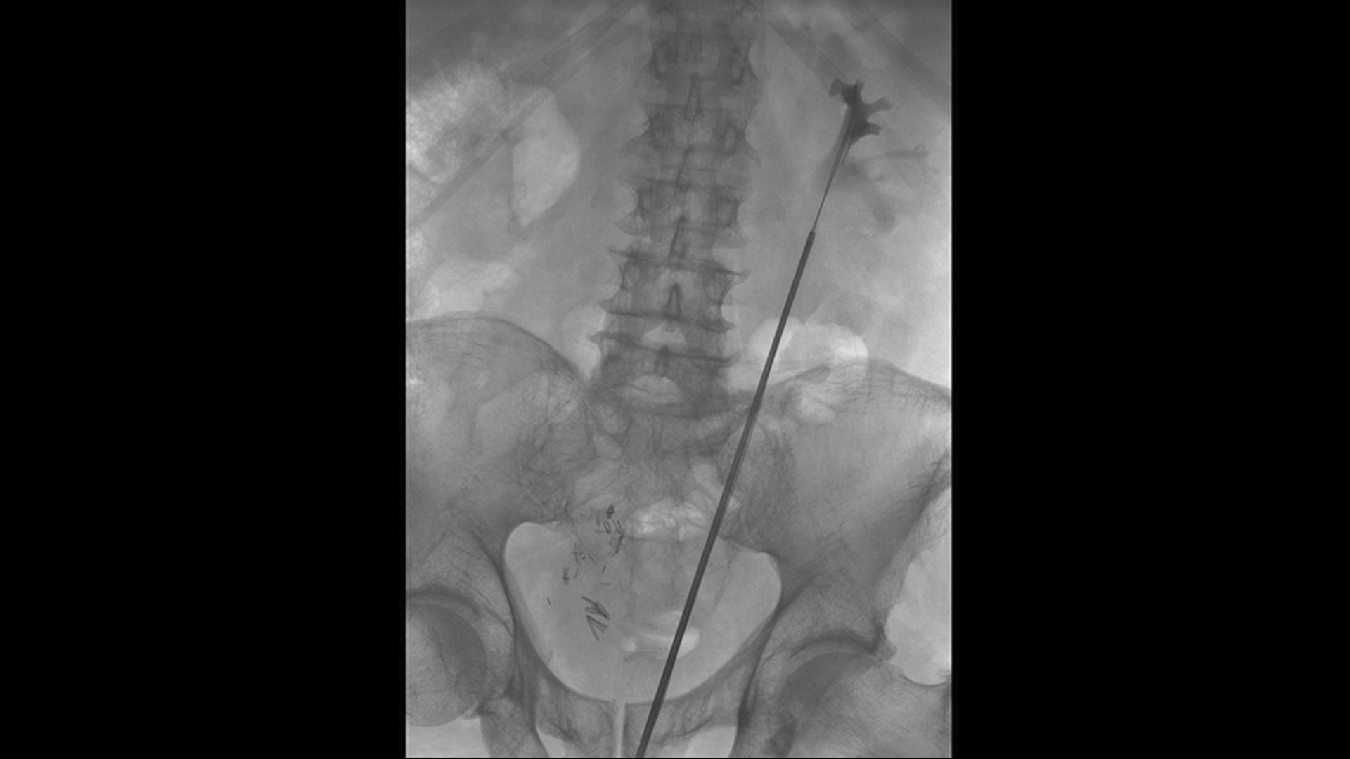 Urology device Uroskop Omnia Max